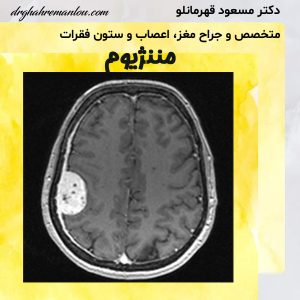 مننژیوم - دکتر مسعود قهرمانلو - drghahremanlou.com