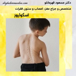 اسکولیوز - دکتر مسعود قهرمانلو - drghahremanlou.com