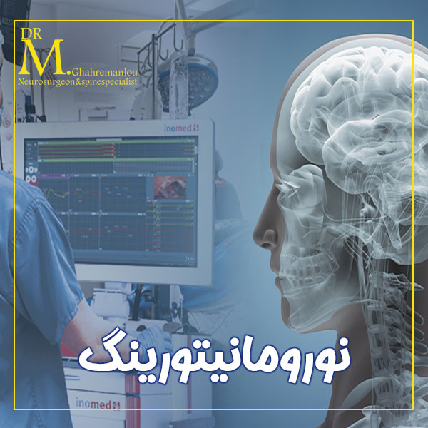نورومانیتورینگ + دکتر مسعود قهرمانلو