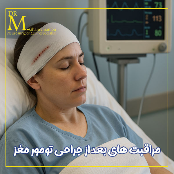 رعایت مراقبت های بعد از جراحی تومور مغز + دکتر مسعود قهرمانلو